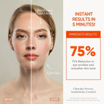 7 Color Rechargeable LED skin care advertisement showing before and after woman face with lifted hooded eyelid, brow, and jaw plus 75% reduction in eye wrinkles