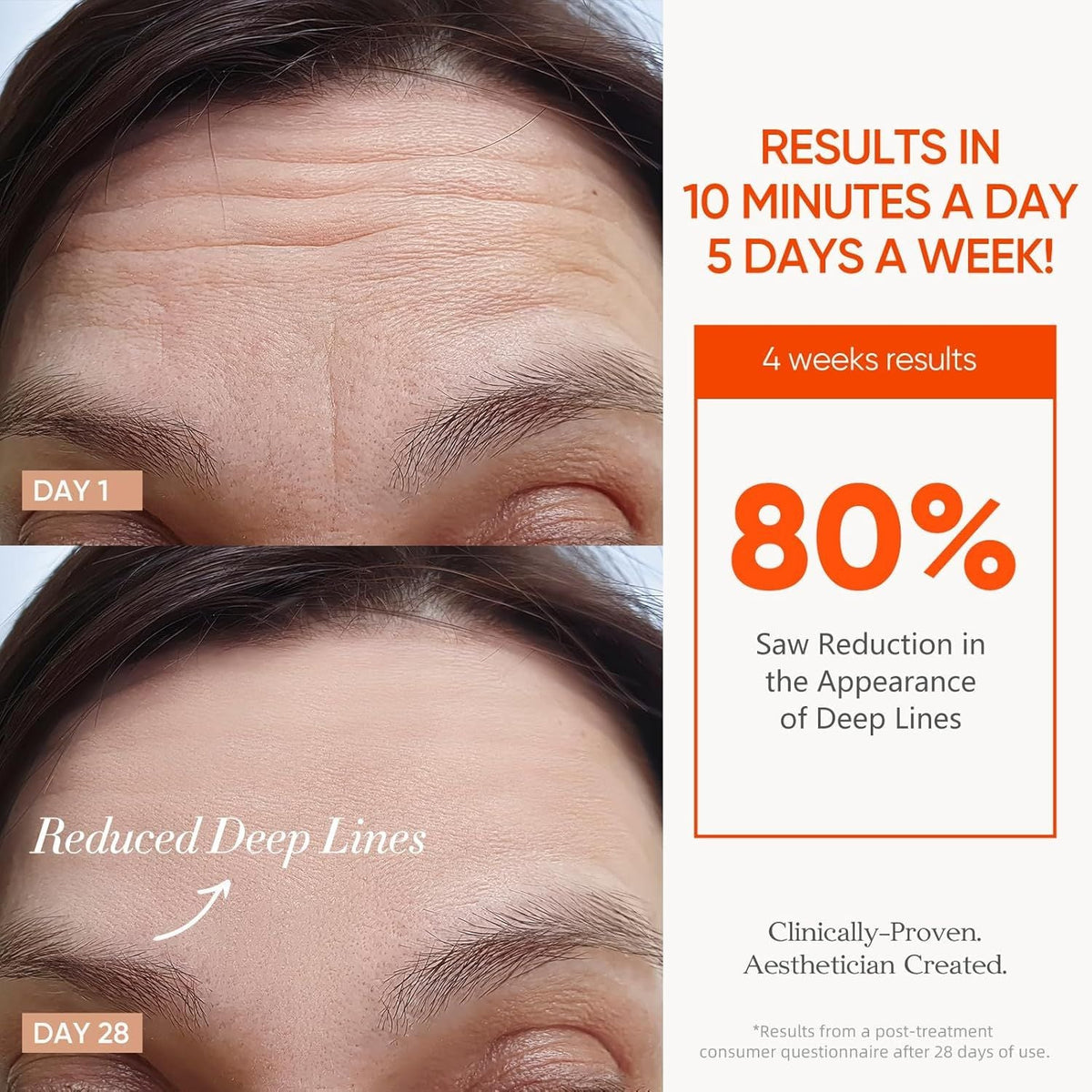 7 Color Rechargeable LED skincare results showing reduced deep forehead lines after 28 days of use with 80% improvement