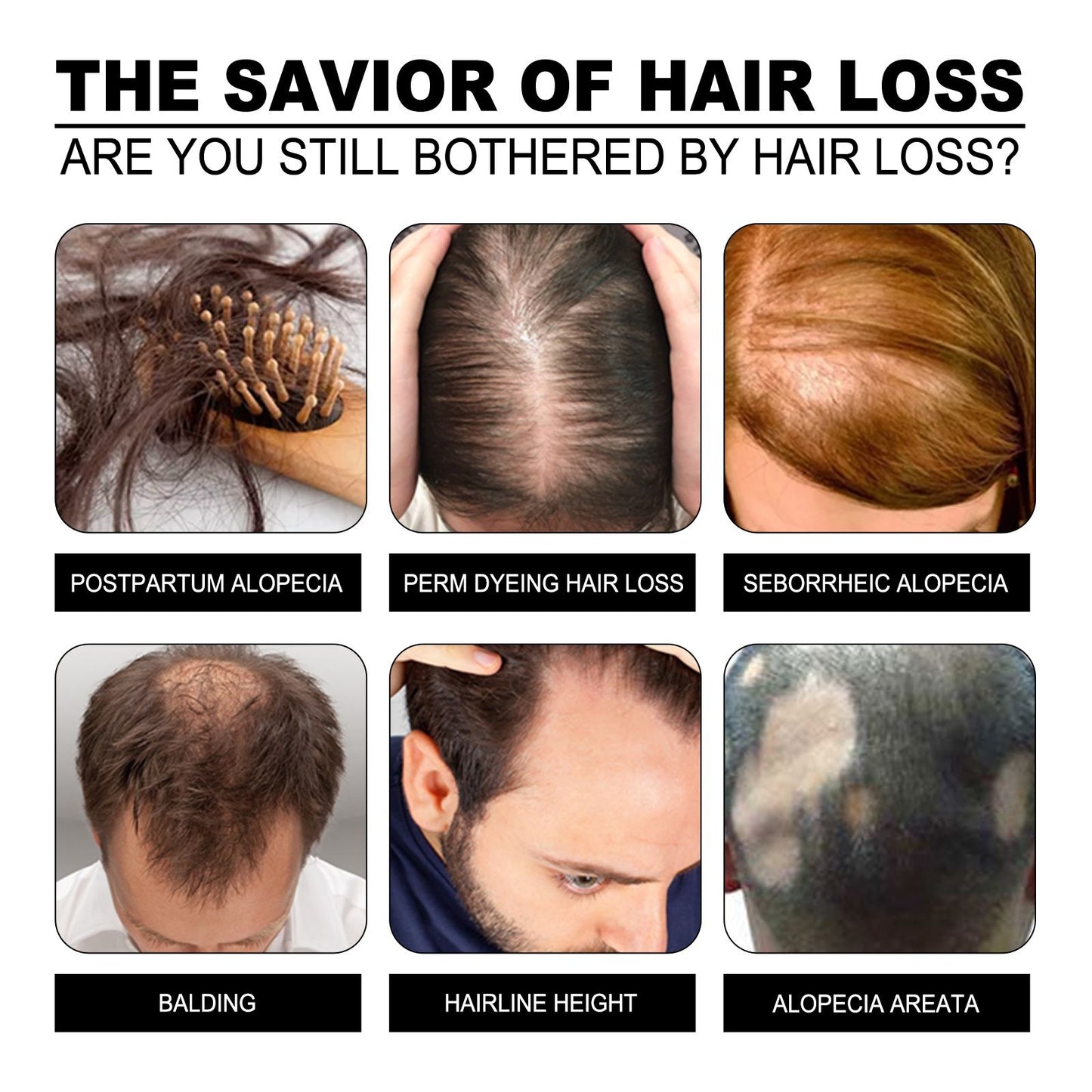 Nourishing Rice Shampoo Soap for Lustrous Hair Restoration benefits illustrated. A collage of images showcasing various hair loss concerns such as balding and alopecia, emphasizing the soap as a solution.