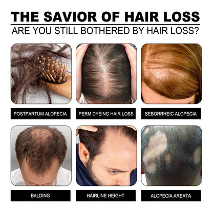 Nourishing Rice Shampoo Soap for Lustrous Hair Restoration benefits illustrated. A collage of images showcasing various hair loss concerns such as balding and alopecia, emphasizing the soap as a solution.