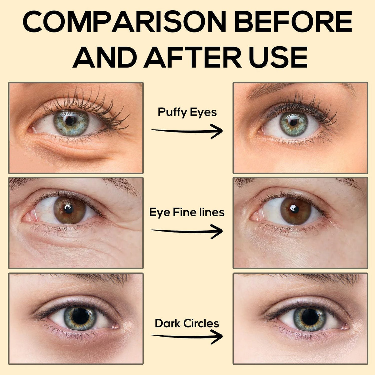 Comparison of eyes showing reduced puffiness, fine lines, and dark circles after using Golden Peptide Collagen eye patches