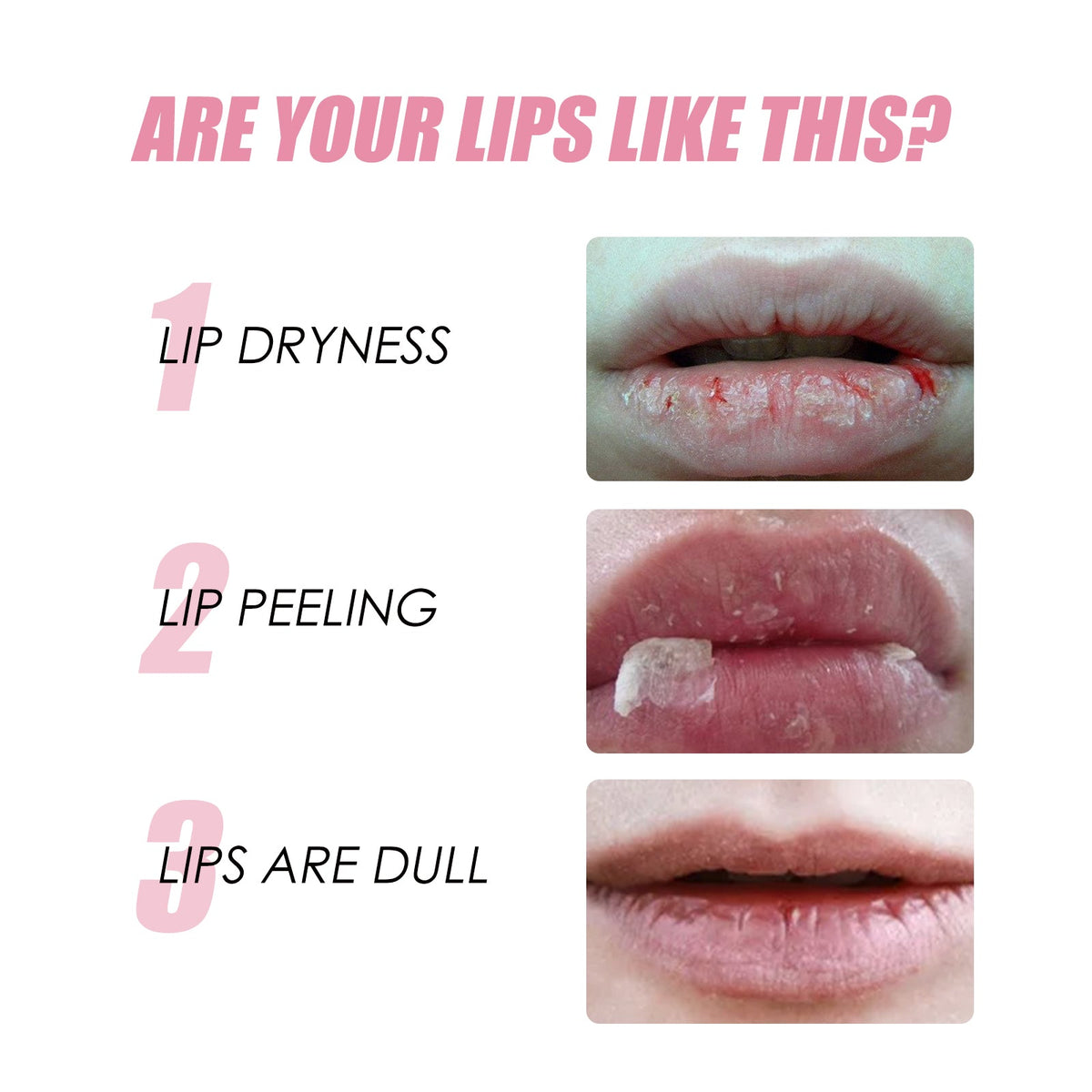 chart showing lip dryness, lip peeling, and dull lips with corresponding close-up photos of damaged lips illustrating dryness, peeling, and dullness for Honey Infused Lip Oil