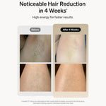 before and after close-up images showing reduced hair on skin after using Laser Epilator IPL for 4 weeks, demonstrating smoother skin