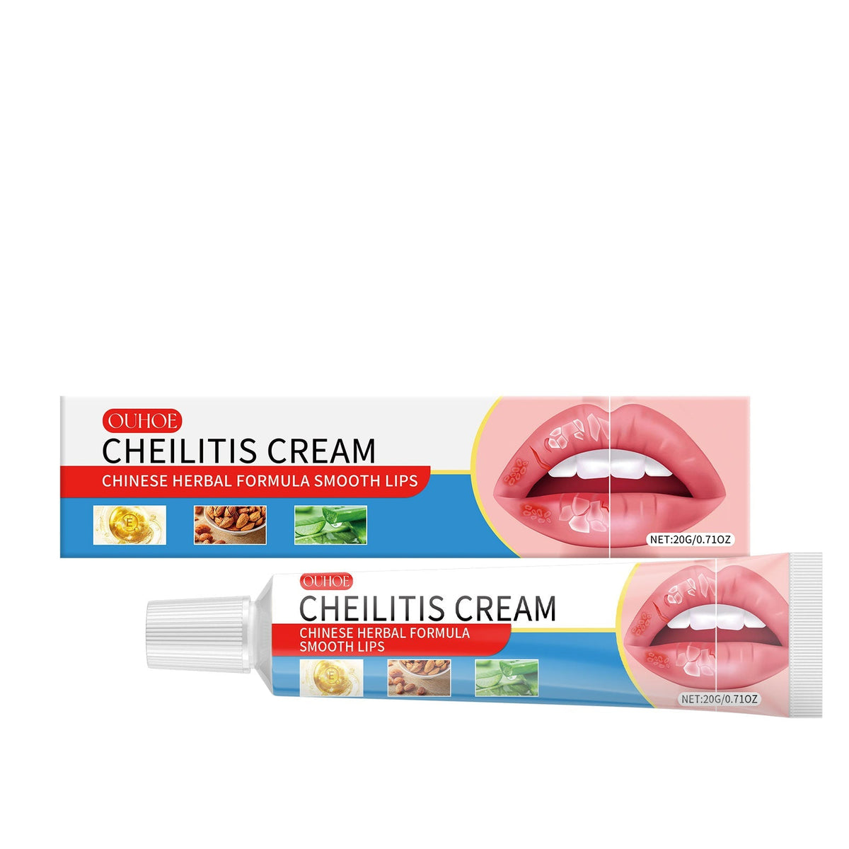 Cheilitis cream tube with white cap and blue, red, and white packaging featuring lips illustration, designed as a Lip Moisturizer.