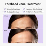 Marée forehead wrinkle patches with hydrogel anti-aging formula
