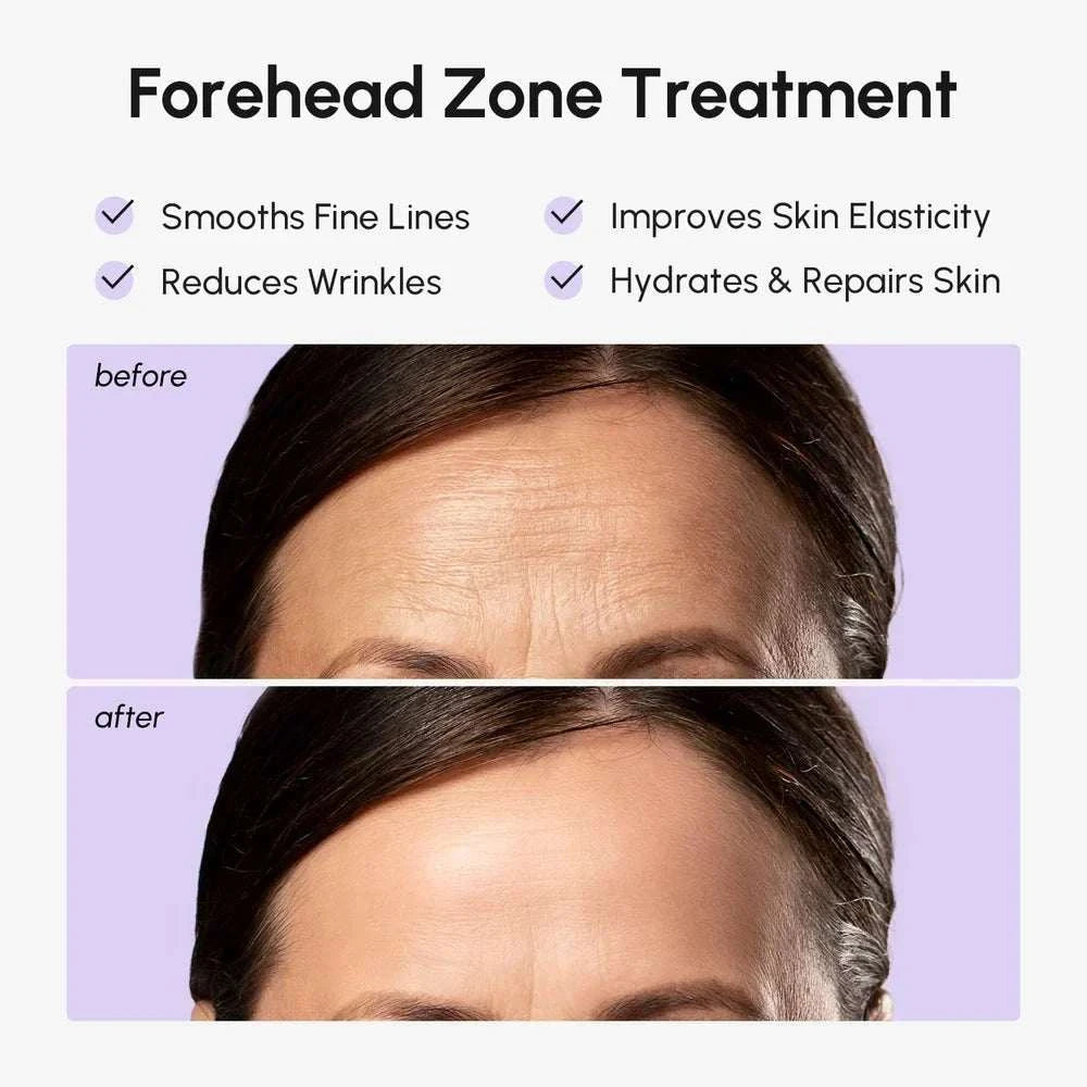 Marée forehead wrinkle patches with hydrogel anti-aging formula